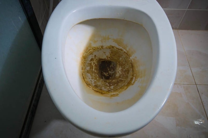 Hardnekkige urinesteen verwijderen